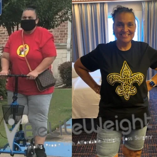 Susan H - 1 Year Update*